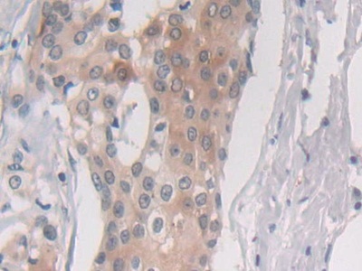 Polyclonal Antibody to Proteasome Subunit Beta Type 6 (PSMb6)