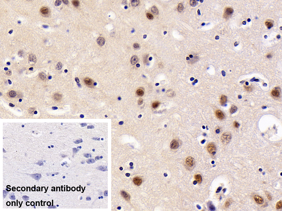 Polyclonal Antibody to Proteasome 26S Subunit, Non ATPase 4 (PSMD4)