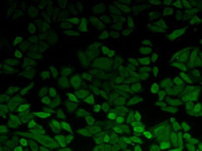 Polyclonal Antibody to Phosphoglycerate Kinase 1 (PGK1)