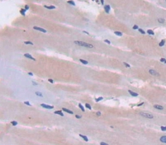 Polyclonal Antibody to Nephroblastoma Overexpressed Gene (NOV)