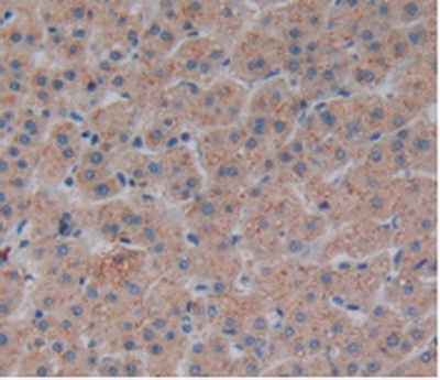 Polyclonal Antibody to Corin (CRN)