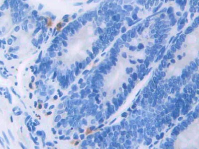 Polyclonal Antibody to Channel Activating Protease 1 (CAP1)