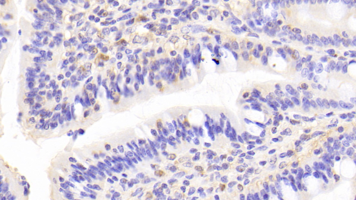 Polyclonal Antibody to Selenium Binding Protein 1 (SELENBP1)