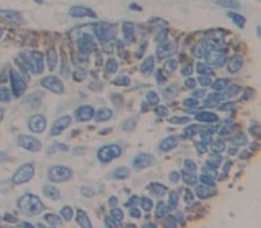 Polyclonal Antibody to Desmocollin 2 (DSC2)