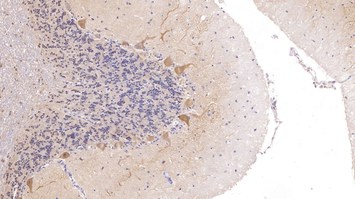 Polyclonal Antibody to Calbindin (CALB)