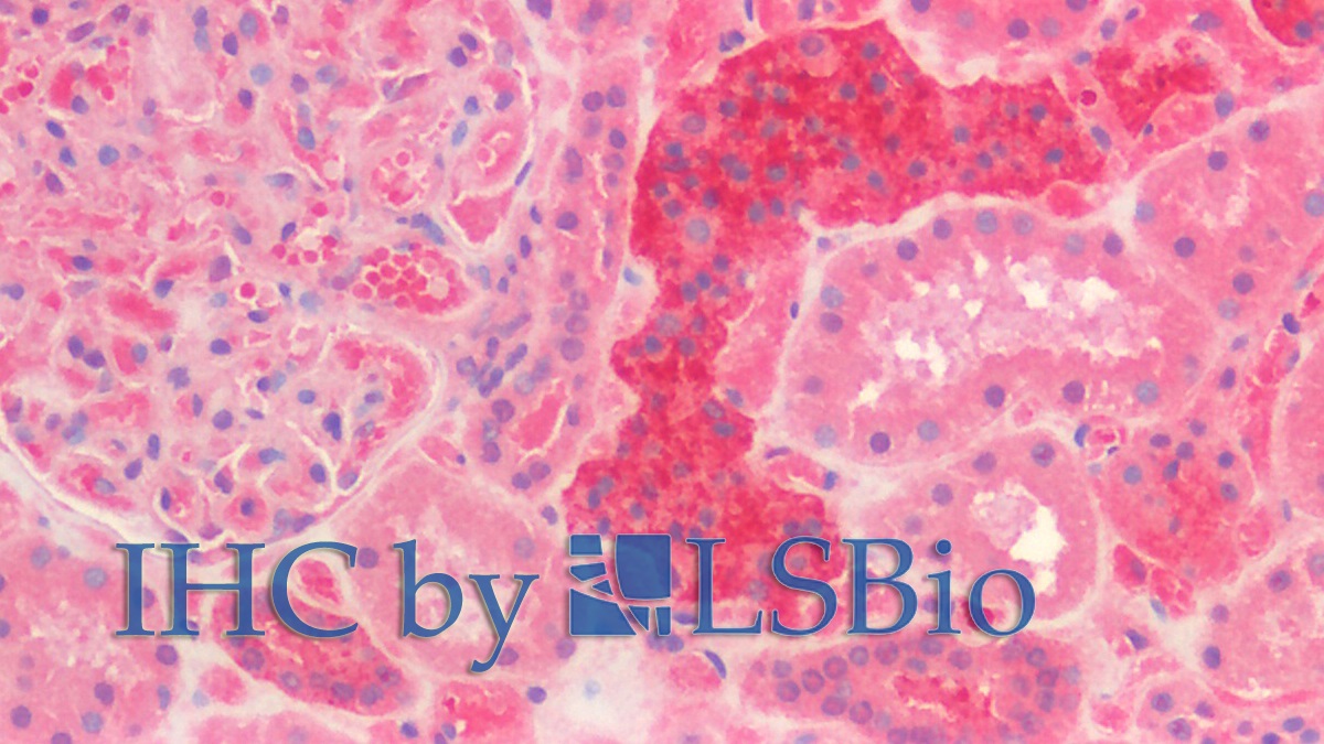 Polyclonal Antibody to Calbindin (CALB)