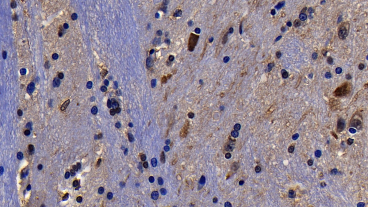 Polyclonal Antibody to Parvalbumin (PVALB)