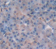 Polyclonal Antibody to Statherin (STATH)