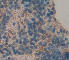 Polyclonal Antibody to Endoplasmic Reticulum Aminopeptidase 2 (ERAP2)