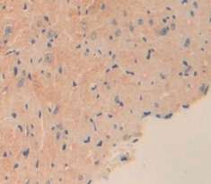 Polyclonal Antibody to Cerebral Dopamine Neurotrophic Factor (CDNF)