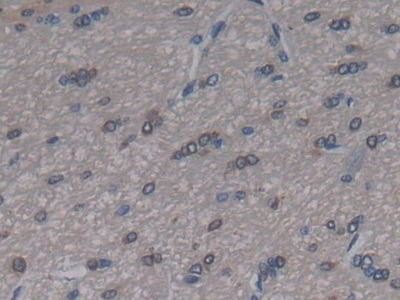 Polyclonal Antibody to Cerebral Dopamine Neurotrophic Factor (CDNF)