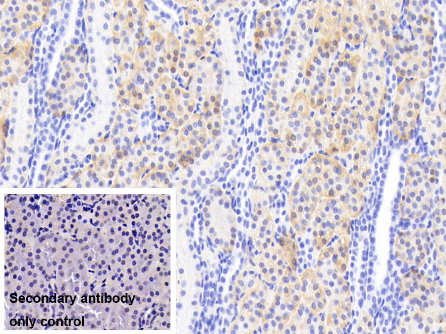 Polyclonal Antibody to Dopa Decarboxylase (DDC)