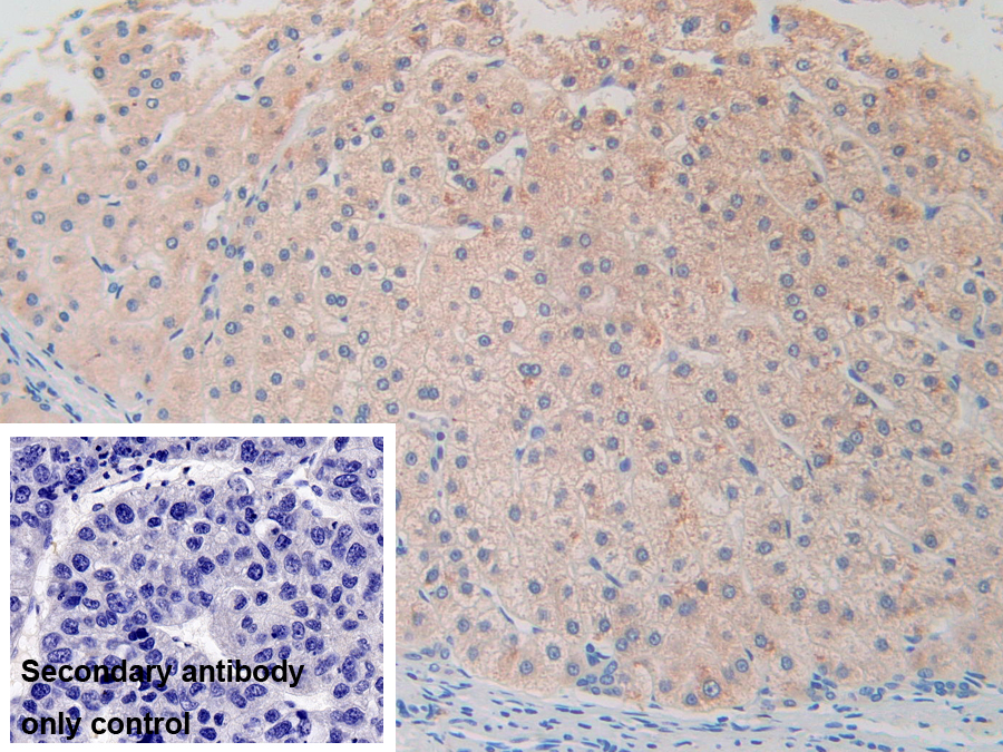 Polyclonal Antibody to Glycine Dehydrogenase (GLDC)