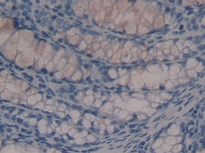 Polyclonal Antibody to Histidine Decarboxylase (HDC)