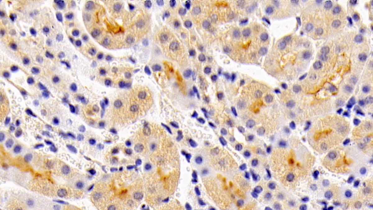 Polyclonal Antibody to Lipocalin 12 (LCN12)