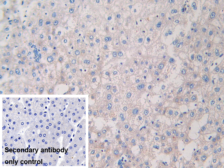 Polyclonal Antibody to Microtubule Associated Protein RP/EB Family, Member 1 (MAPRE1)