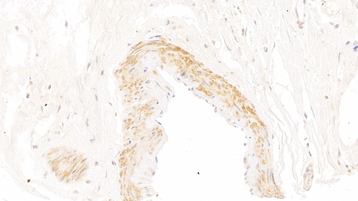 Polyclonal Antibody to Secretoglobin Family 2A, Member 2 (SCGB2A2)