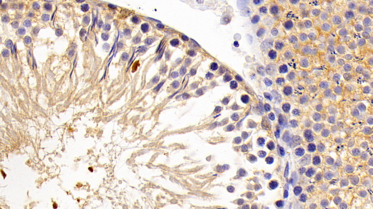 Polyclonal Antibody to Lipin 1 (LPIN1)