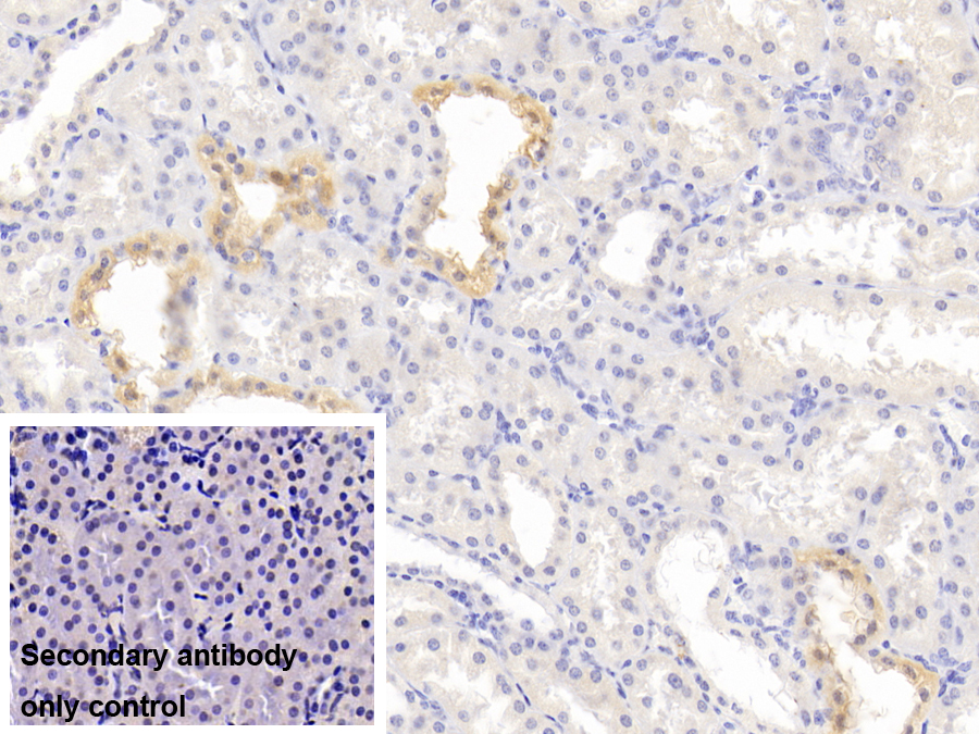 Polyclonal Antibody to Steroidogenic Acute Regulatory Protein (STAR)