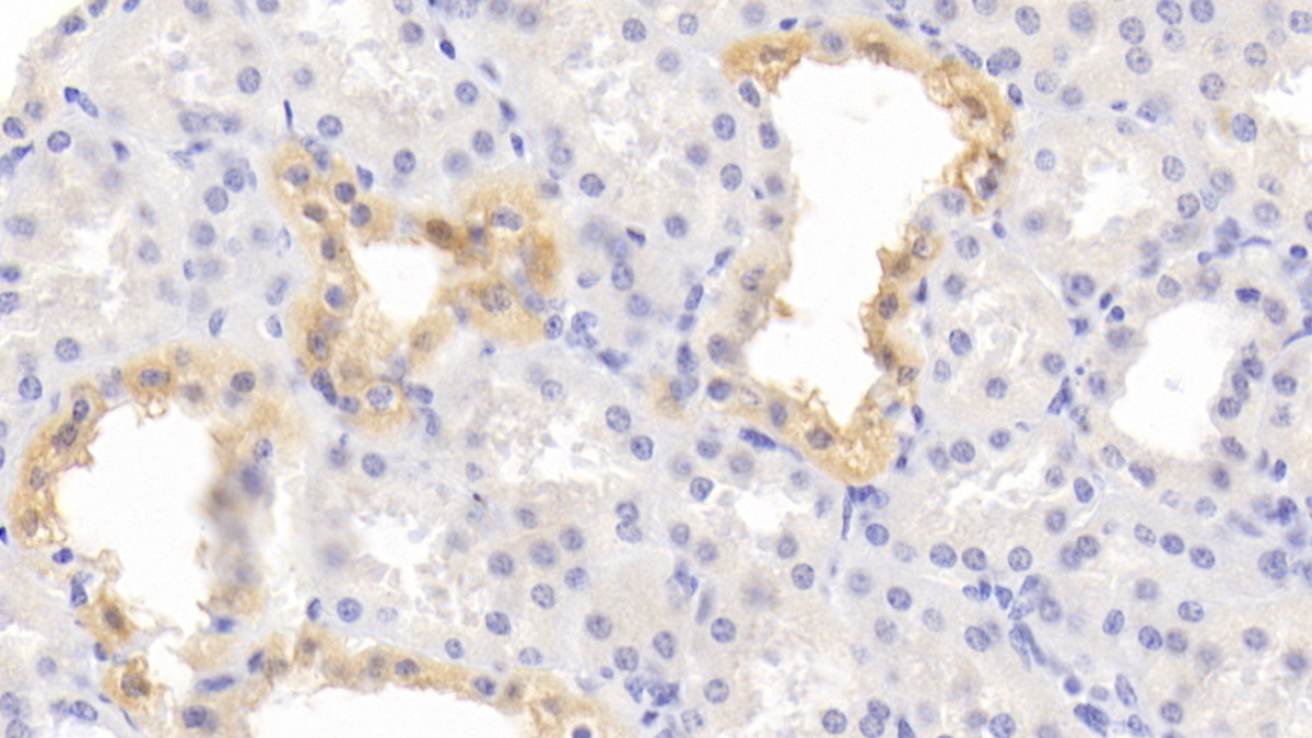 Polyclonal Antibody to Steroidogenic Acute Regulatory Protein (STAR)