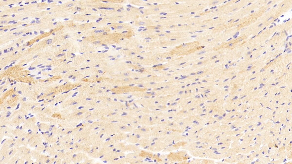 Polyclonal Antibody to Receptor Tyrosine Kinase Like Orphan Receptor 1 (ROR1)