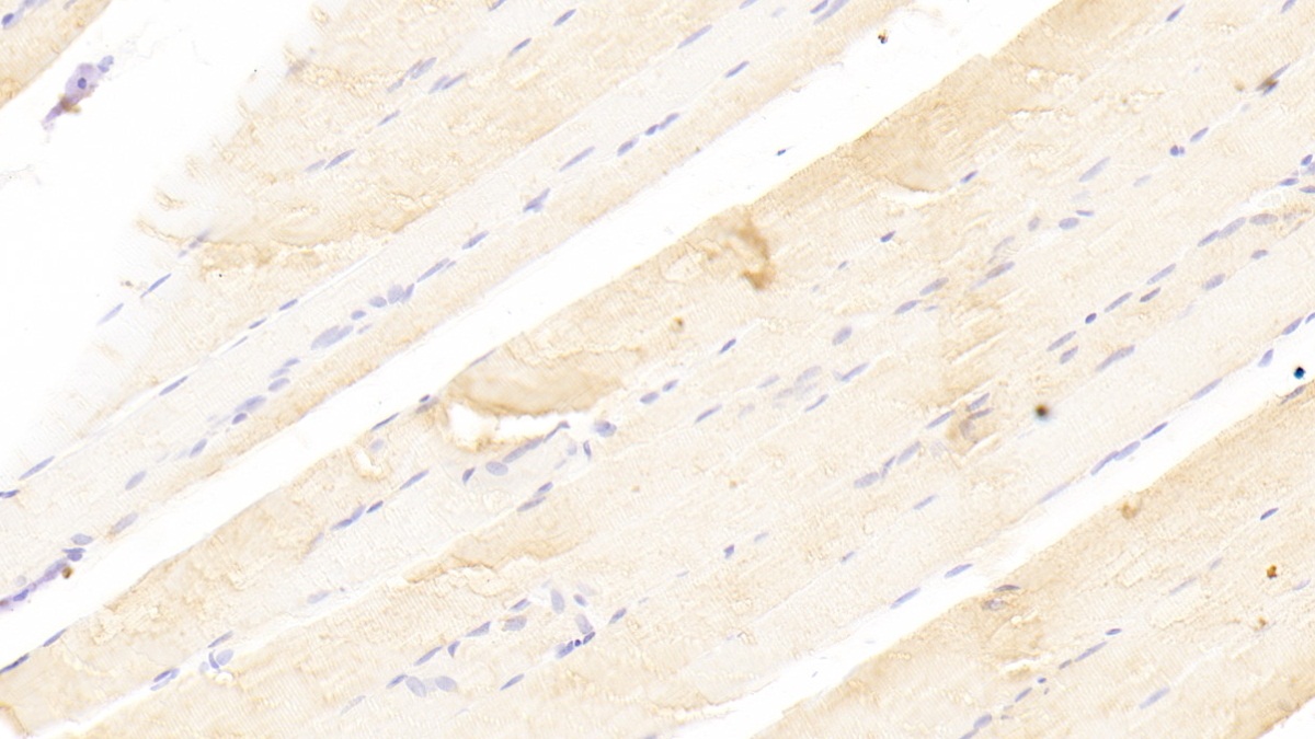 Polyclonal Antibody to Dual Serine/Threonine And Tyrosine Protein Kinase (DSTYK)