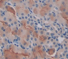 Polyclonal Antibody to Lysophosphatidylcholine Acyltransferase 1 (LPCAT1)