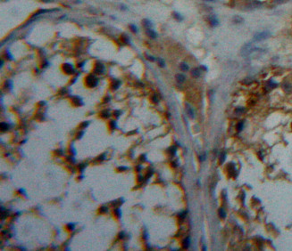 Polyclonal Antibody to Phosphoprotein Associated With Glycosphingolipid Microdomains 1 (PAG1)