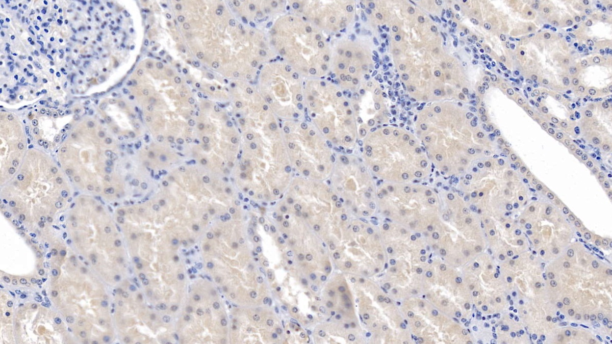 Polyclonal Antibody to Excitatory Amino Acid Transporter 4 (EAAT4)