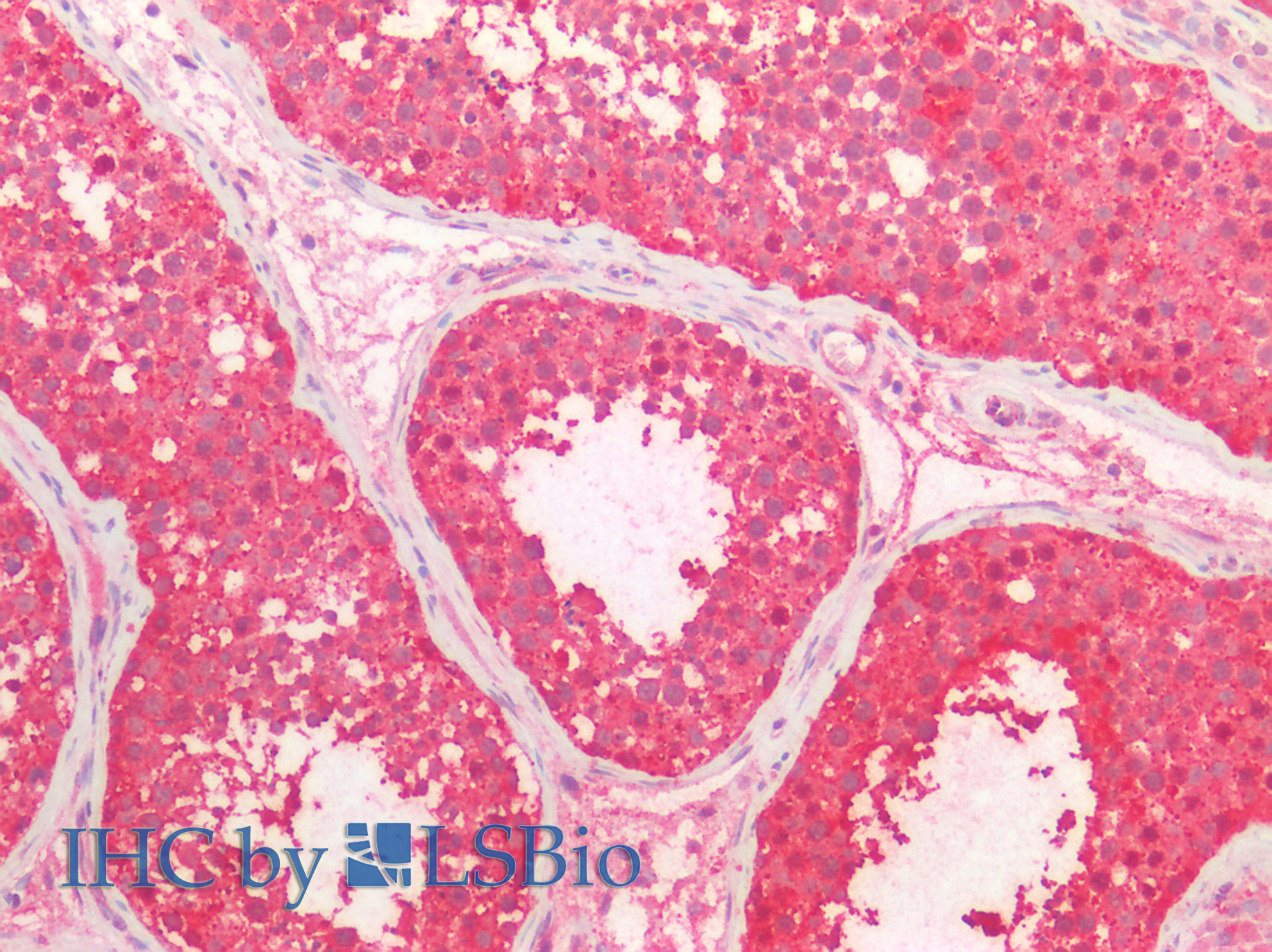 Polyclonal Antibody to Fatty Acid Transport Protein 1 (FATP1)