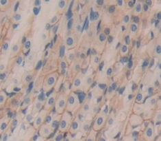 Polyclonal Antibody to Galactosylceramidase (GALC)