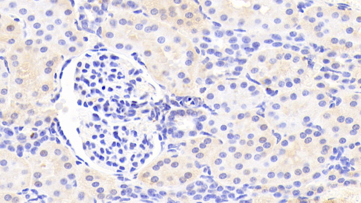 Polyclonal Antibody to Arylsulfatase F (ARSF)