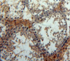 Polyclonal Antibody to Palmitoyl Protein Thioesterase 1 (PPT1)