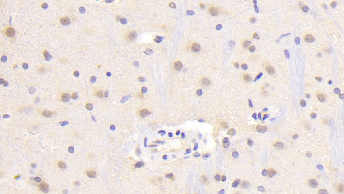 Polyclonal Antibody to Triggering Receptor Expressed On Myeloid Cells 2 (TREM2)