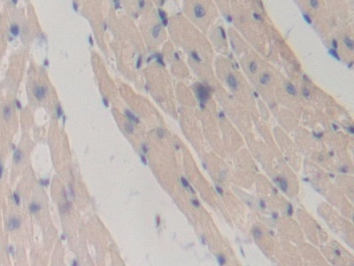 Polyclonal Antibody to Torsin 1A (TOR1A)