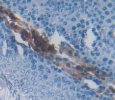 Polyclonal Antibody to RNA Binding Motif Protein 3 (RBM3)