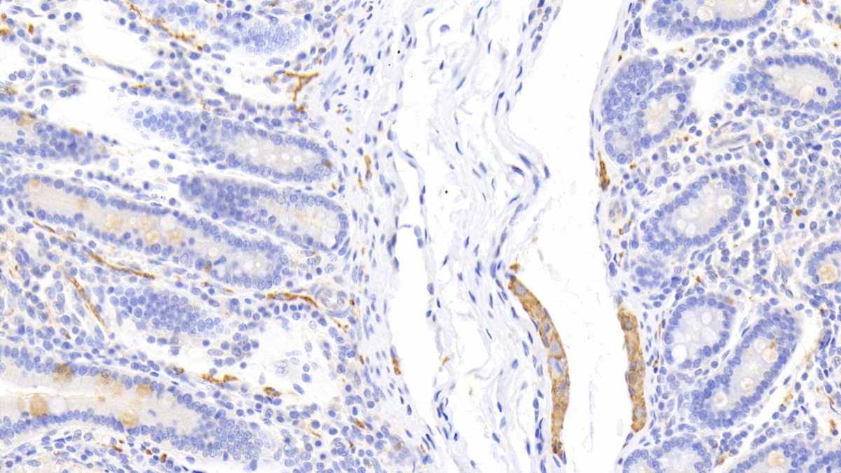 Polyclonal Antibody to Chloride Channel Accessory 1 (CLCA1)