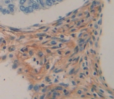 Polyclonal Antibody to Myopalladin (MYPN)