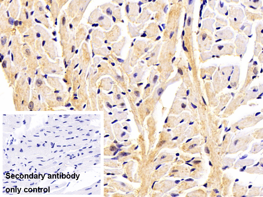 Polyclonal Antibody to Tropomodulin 3 (TMOD3)