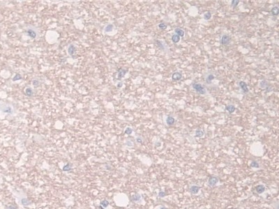 Polyclonal Antibody to Breast Cancer Anti-Estrogen Resistance 1 (BCAR1)