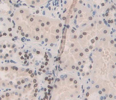 Polyclonal Antibody to Transcription Termination Factor, RNA polymerase I (TTF1)