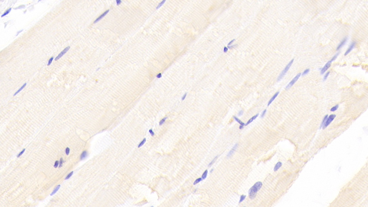 Polyclonal Antibody to Transcobalamin II, Macrocytic Anemia (TCN2)