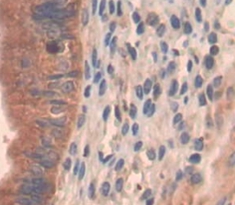 Polyclonal Antibody to Phosphatidylinositol-4-Kinase Catalytic Alpha (PI4Ka)