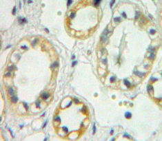 Polyclonal Antibody to Trehalase (TREH)