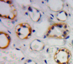 Polyclonal Antibody to Trehalase (TREH)