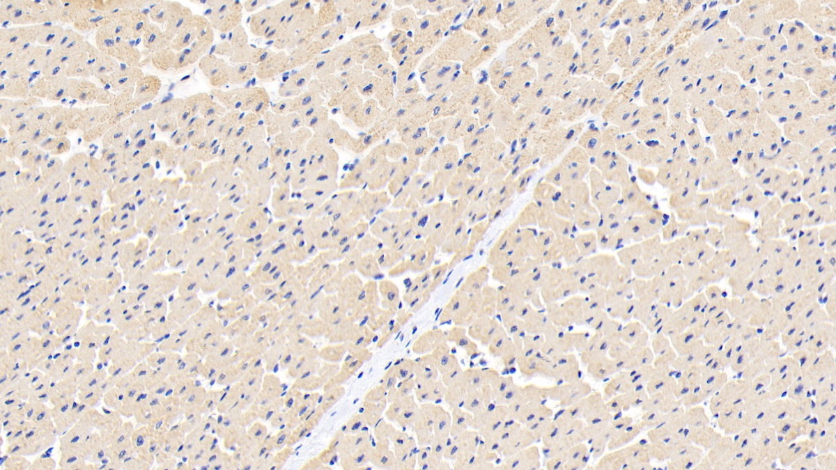 Polyclonal Antibody to Ankyrin Repeat Domain Protein 1 (ANKRD1)