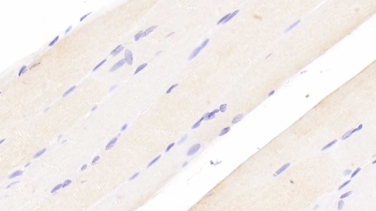 Polyclonal Antibody to Ankyrin Repeat Domain Protein 1 (ANKRD1)