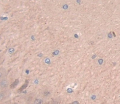 Polyclonal Antibody to WNT1 Inducible Signaling Pathway Protein 2 (WISP2)