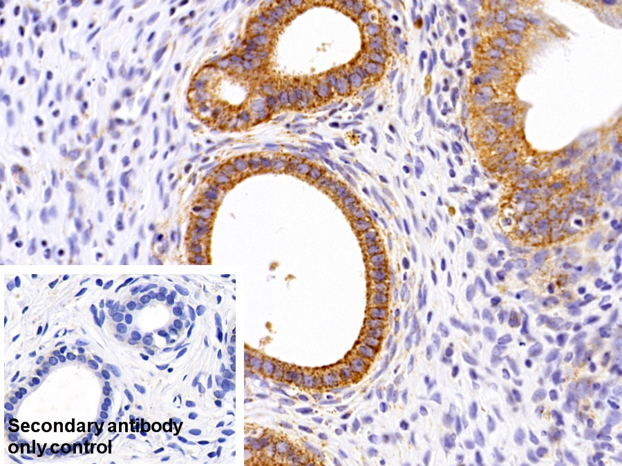 Polyclonal Antibody to Voltage Dependent Anion Channel Protein 1 (VDAC1)