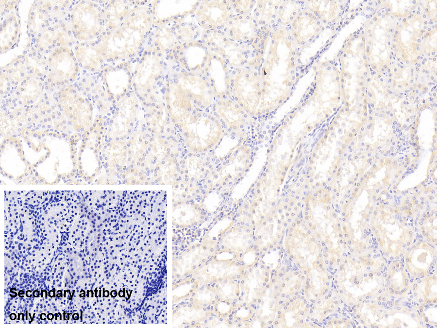 Polyclonal Antibody to Vasorin (VASN)